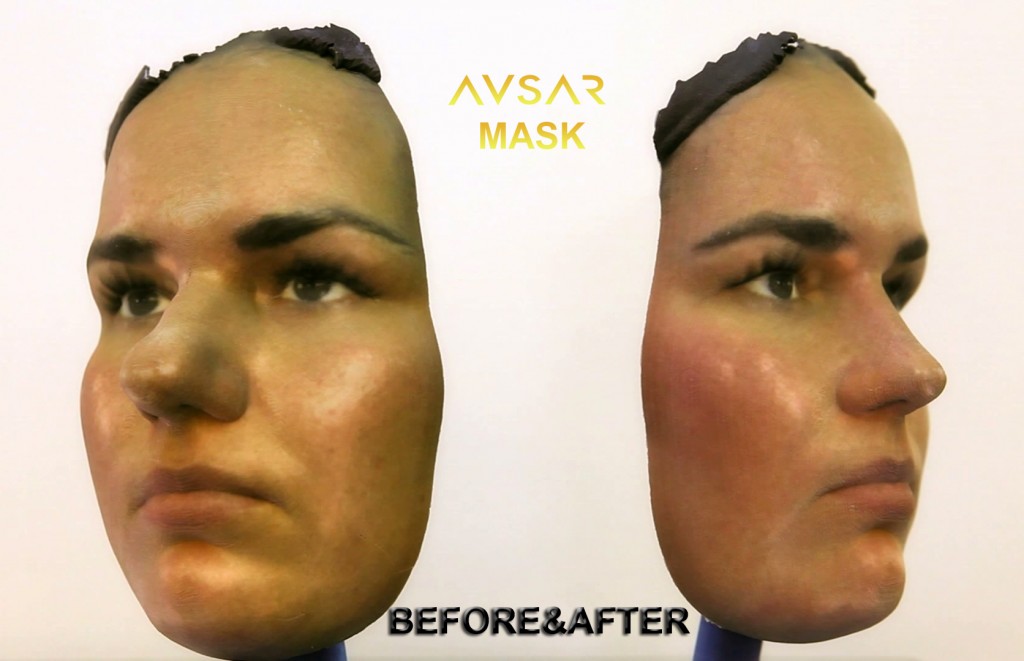 Avşar Mask 3d printing rinoplasti